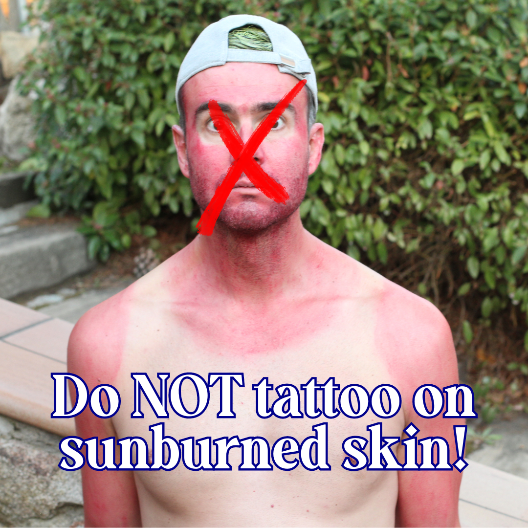 Tattoo Feels Like a Sunburn? You’re Not Alone